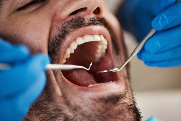 Best Urgent Tooth Repair  in Orange, TX